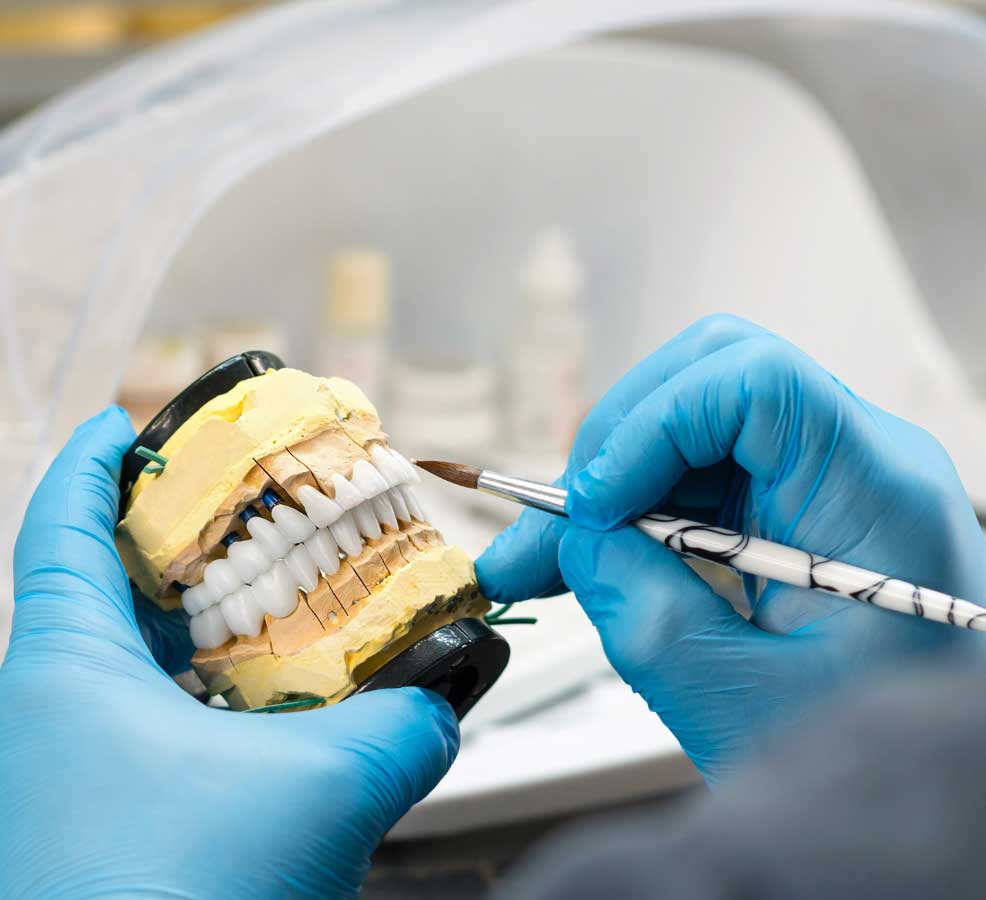 A dental technician in blue gloves carefully adjusts a dental prosthesis mounted in a clamp in a well-equipped laboratory