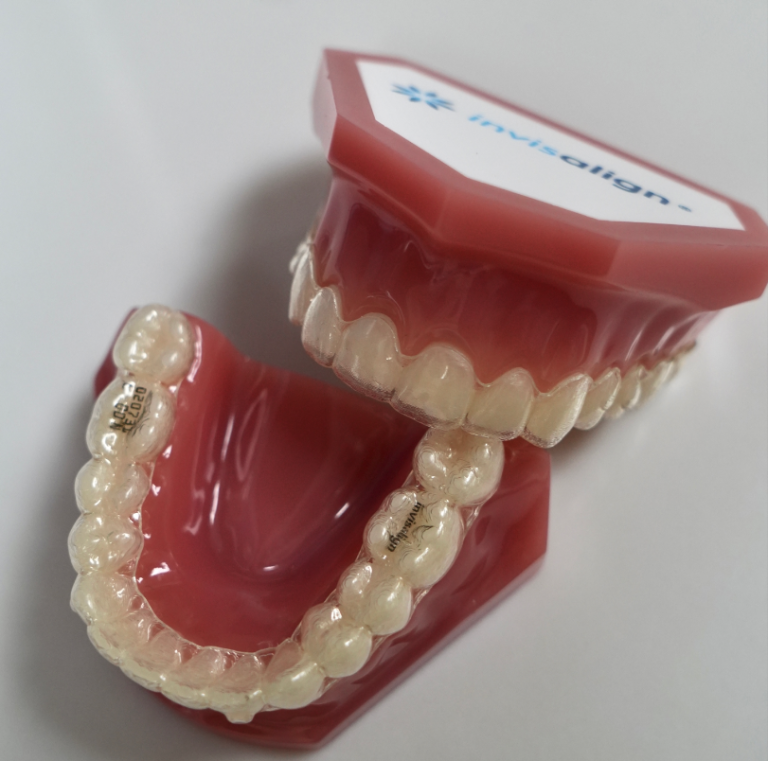 How Invisalign Transforms Your Smile Without Braces